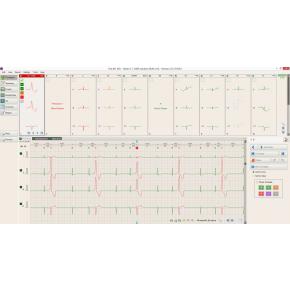 BTL-08 CardioPoint-Holter H100  